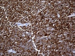 SH3BP1 Monoclonal Antibody (OTI2F4), TrueMAB , OriGene:Antibodies:Primary