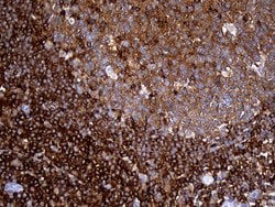 SH3BP1 Monoclonal Antibody (OTI2F4), TrueMAB , OriGene 100 &mu;L; Unconjugated:Antibodies,