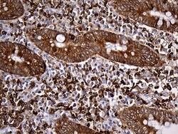 SH3BP1 Monoclonal Antibody (OTI2F4), TrueMAB , OriGene 100 &mu;L; Unconjugated:Antibodies,