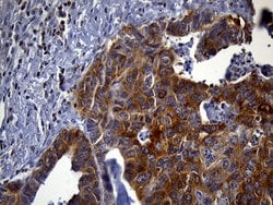 SH3BP1 Monoclonal Antibody (OTI2C7), TrueMAB , OriGene:Antibodies:Primary