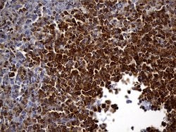 SH3BP1 Monoclonal Antibody (OTI2C7), TrueMAB , OriGene 100 &mu;L; Unconjugated:Antibodies,