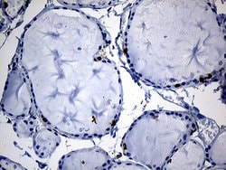 SH3BP1 Monoclonal Antibody (OTI1C9), TrueMAB , OriGene 100 &mu;L; Unconjugated:Antibodies,