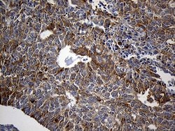 SH3BP1 Monoclonal Antibody (OTI1C9), TrueMAB , OriGene 100 &mu;L; Unconjugated:Antibodies,