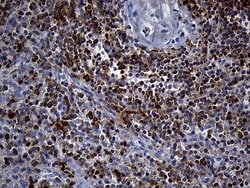 SH3BP1 Monoclonal Antibody (OTI1C9), TrueMAB , OriGene 100 &mu;L; Unconjugated:Antibodies,
