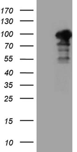 SH3BP1 Mouse anti-Human, Clone: OTI3G1, lyophilized, TrueMAB 100 &mu;g;