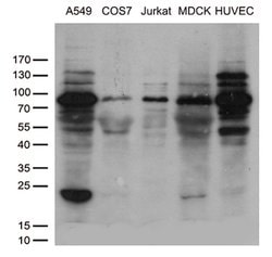 SH3BP1 Mouse anti-Human, Clone: OTI3G1, lyophilized, TrueMAB 100 &mu;g;