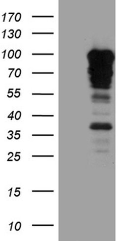 SH3BP1 Monoclonal Antibody (OTI2C7), TrueMAB , OriGene:Antibodies:Primary