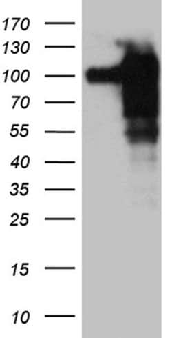 SH3BP1 Monoclonal Antibody (OTI1C9), TrueMAB , OriGene 100 &mu;L; Unconjugated:Antibodies,