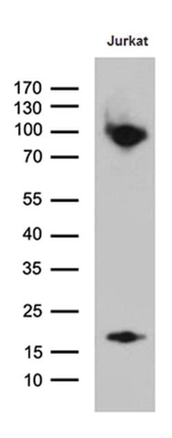 SH3BP1 Monoclonal Antibody (OTI1C9), TrueMAB , OriGene 100 &mu;L; Unconjugated:Antibodies,
