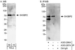 SH3BP2 Rabbit anti-Human, Polyclonal, Bethyl Laboratories 100 &mu;L; Unconjugated:Antibodies,