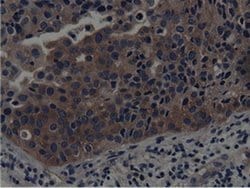 SH3GL1 Monoclonal Antibody (OTI3F8), TrueMAB , OriGene 100 &mu;L; Unconjugated:Antibodies,