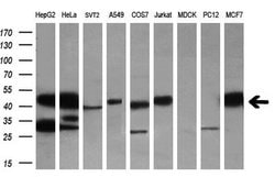 SH3GL1 Monoclonal Antibody (OTI3F8), TrueMAB , OriGene 100 &mu;L; Unconjugated:Antibodies,