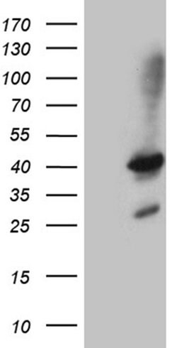 SHARPIN Mouse anti-Human, Clone: OTI1F4, liquid, TrueMAB 100 &mu;L; Unconjugated:Antibodies,