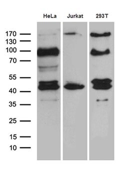 SHARPIN Mouse anti-Human, Clone: OTI1F4, liquid, TrueMAB 100 &mu;L; Unconjugated:Antibodies,