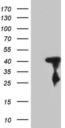 SHARPIN Monoclonal Antibody (OTI2B1), TrueMAB , OriGene:Antibodies:Primary