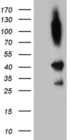 SHARPIN Monoclonal Antibody (OTI1D11), TrueMAB , OriGene 100 &mu;L; Unconjugated:Antibodies,