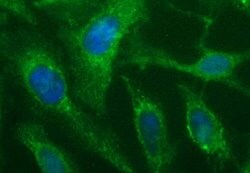 SHBG Monoclonal Antibody (OTI1G2), TrueMAB , OriGene 30 &mu;L; Unconjugated:Antibodies,