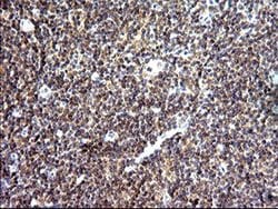 SHBG Monoclonal Antibody (OTI1D10), TrueMAB , OriGene 100 &mu;L; Unconjugated:Antibodies,