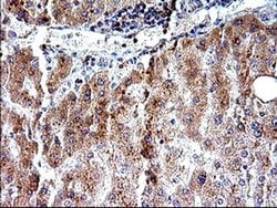 SHBG Monoclonal Antibody (OTI1D10), TrueMAB , OriGene 100 &mu;L; Unconjugated:Antibodies,