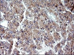 SHBG Monoclonal Antibody (OTI1D10), TrueMAB , OriGene 100 &mu;L; Unconjugated:Antibodies,