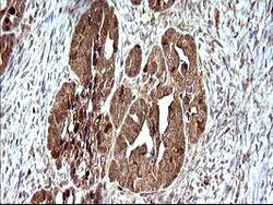 SHBG Mouse anti-Human, Clone: OTI1A6, lyophilized, TrueMAB 100 &mu;g; Unconjugated:Antibodies,
