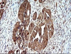 SHBG Monoclonal Antibody (OTI1A6), TrueMAB , OriGene 100 &mu;L; Unconjugated:Antibodies,