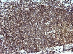 SHBG Mouse anti-Human, Clone: OTI1A6, lyophilized, TrueMAB 100 &mu;g; Unconjugated:Antibodies,