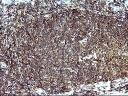 SHBG Monoclonal Antibody (OTI1A6), TrueMAB , OriGene 100 &mu;L; Unconjugated:Antibodies,