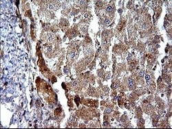SHBG Mouse anti-Human, Clone: OTI1A6, lyophilized, TrueMAB 100 &mu;g; Unconjugated:Antibodies,