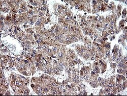 SHBG Mouse anti-Human, Clone: OTI1A6, lyophilized, TrueMAB 100 &mu;g; Unconjugated:Antibodies,