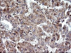 SHBG Monoclonal Antibody (OTI1A6), TrueMAB , OriGene 100 &mu;L; Unconjugated:Antibodies,