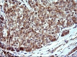SHBG Monoclonal Antibody (OTI1H10), TrueMAB , OriGene 100 &mu;L; Unconjugated:Antibodies,