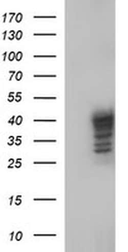 SHBG Monoclonal Antibody (OTI1D10), TrueMAB , OriGene 100 &mu;L; Unconjugated:Antibodies,