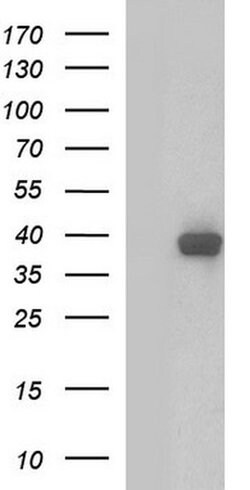 SHBG Monoclonal Antibody (OTI1E7), TrueMAB , OriGene:Antibodies:Primary