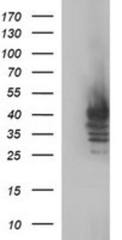 SHBG Mouse anti-Human, Clone: OTI1A6, lyophilized, TrueMAB 100 &mu;g; Unconjugated:Antibodies,
