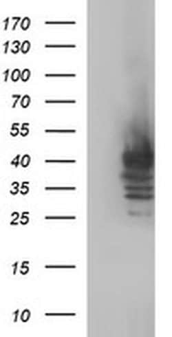 SHBG Monoclonal Antibody (OTI1A6), TrueMAB , OriGene 100 &mu;L; Unconjugated:Antibodies,