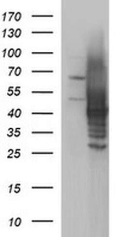 SHBG Monoclonal Antibody (OTI1G2), TrueMAB , OriGene 30 &mu;L; Unconjugated:Antibodies,