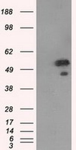 SHC1 Monoclonal Antibody (OTI3H1), TrueMAB , OriGene 100 &mu;L | Buy Online | OriGene | Fisher Scientific