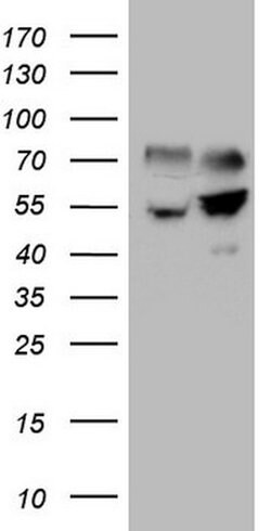 SHMT2 Mouse anti-Human, Clone: OTI1C1, lyophilized, TrueMAB 100 &mu;g;