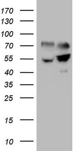 SHMT2 Monoclonal Antibody (OTI1C1), TrueMAB , OriGene 100 &mu;L; Unconjugated:Antibodies,