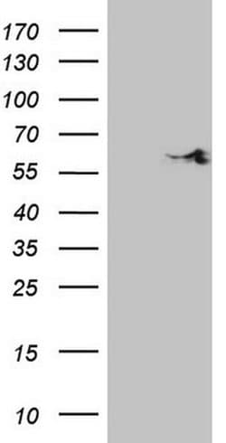 SHMT2 Monoclonal Antibody (OTI5H10), TrueMAB , OriGene:Antibodies:Primary