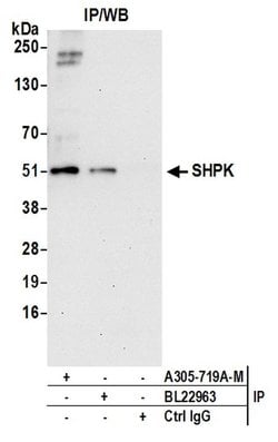 SHPK Polyclonal Antibody, Bethyl Laboratories 20 &mu;L; Unconjugated:Antibodies,