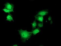 SHPK Monoclonal Antibody (OTI4E9), TrueMAB , OriGene:Antibodies:Primary