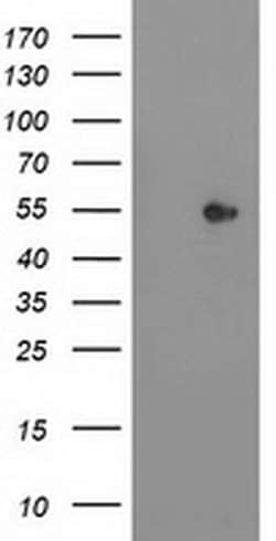 SHPK Monoclonal Antibody (OTI2A12), TrueMAB , OriGene 100 &mu;L; Unconjugated:Antibodies,