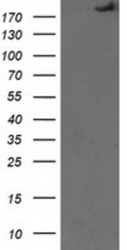 SHPRH Mouse anti-Human, Clone: OTI5G8, lyophilized, TrueMAB 100 &mu;g;