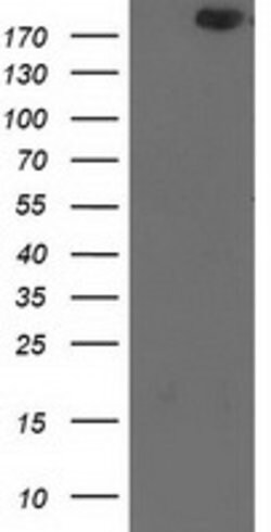SHPRH Mouse anti-Human, Clone: OTI7B2, lyophilized, TrueMAB 100 &mu;g;