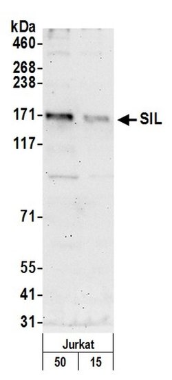 SIL Polyclonal Antibody, Bethyl Laboratories 20 &mu;L; Unconjugated:Antibodies,