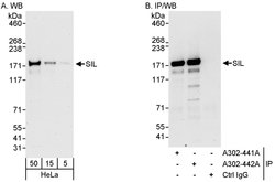 SIL Rabbit anti-Human, Mouse, Polyclonal, Bethyl Laboratories 100 &mu;L;