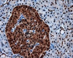 SIL1 Monoclonal Antibody (OTI1F9), TrueMAB , OriGene 100 &mu;L; Unconjugated:Antibodies,
