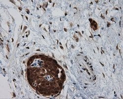 SIL1 Monoclonal Antibody (OTI1F9), TrueMAB , OriGene 100 &mu;L; Unconjugated:Antibodies,